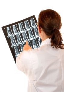 Arzt mit Röntgenfoto Wirbelsäule Skoliose
